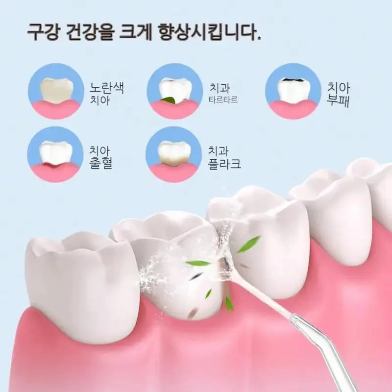Fil à eau électrique, puce intelligente, contrôle précis de la pression, buse rotative à 360 degrés, dispositif de nettoyage des dents